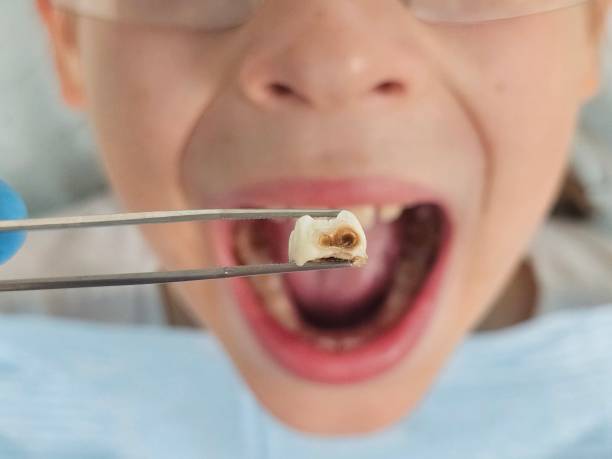 Best Same-Day Emergency Dentist in Seth Ward, TX