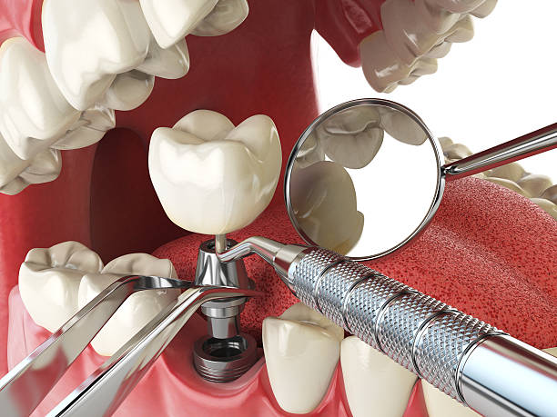 Best Emergency Treatment for Toothache in Seth Ward, TX