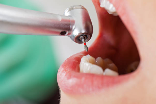 Best Emergency Treatment for Toothache in Seth Ward, TX